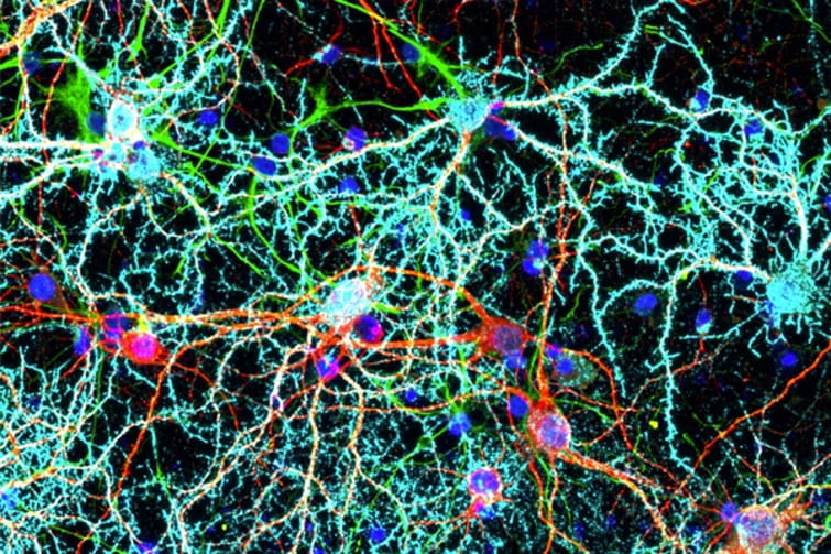 Demystifying nano-neuro interactions